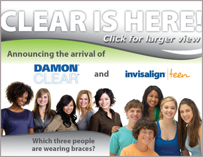 Damon Clear Braces vs. Invisalign Teen